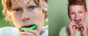 Dental Mouth Guard for dental Care